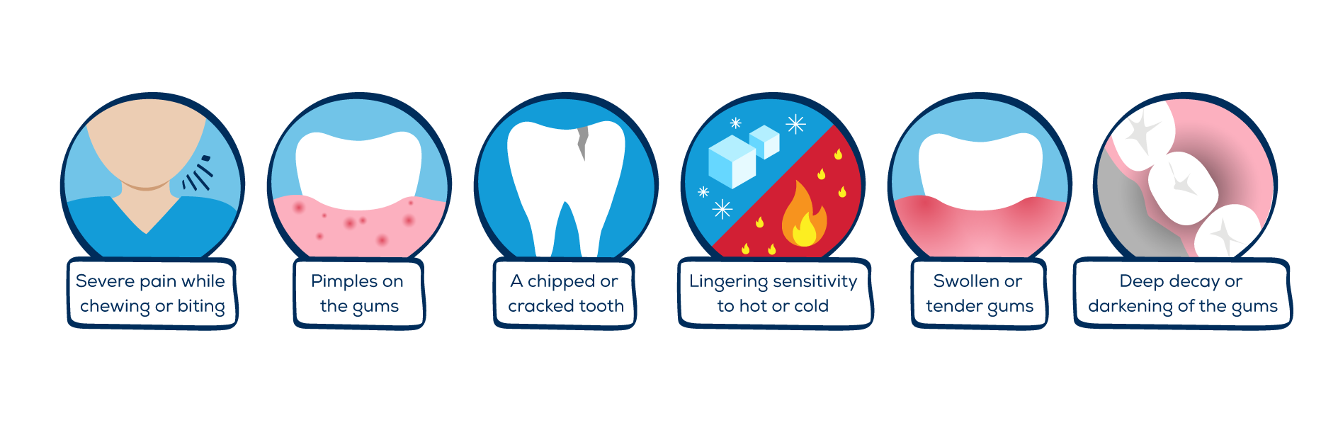 root canal symptoms