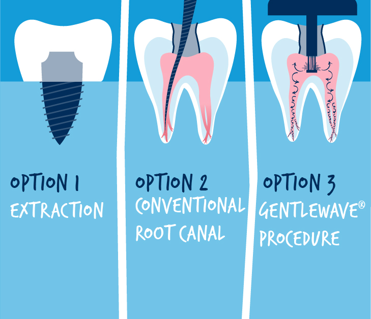 What are my treatment options? 