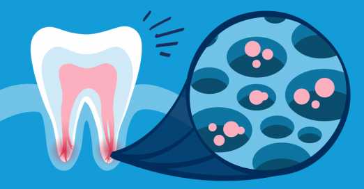 How long does a root canal take